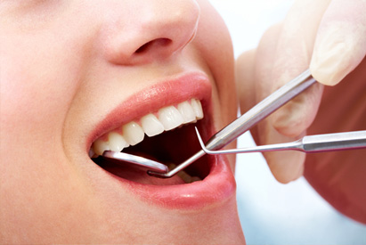How Long Do Dental Veneer Last?